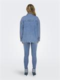 ONLEMMIE L/S SHIRT MB DNM AZ NOOS light blue denim